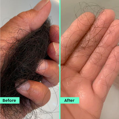 Rosemary Anti Hairfall Shampoo with 3% Rosemary Extract starter